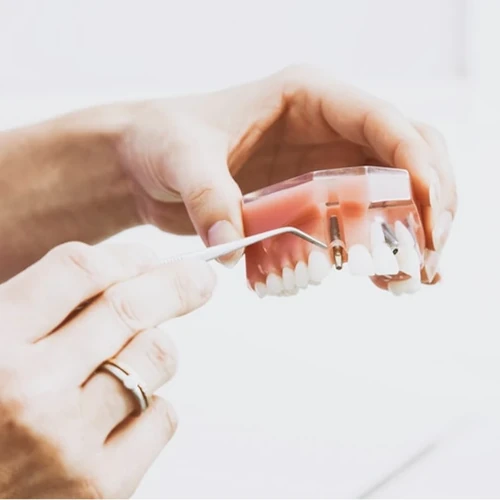 Fotografia que mostra as mãos de um especialista com uma ferramenta apontando para uma réplica de arcada dentária